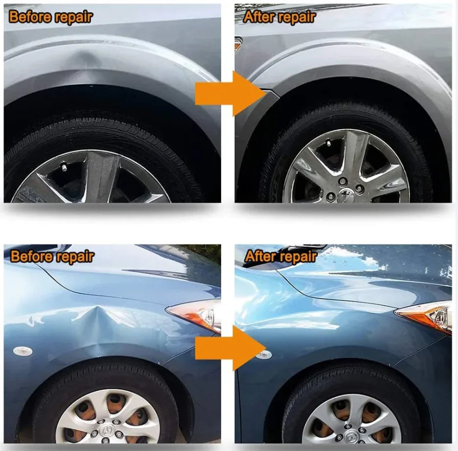 DIY Auto Dent Repair Kit