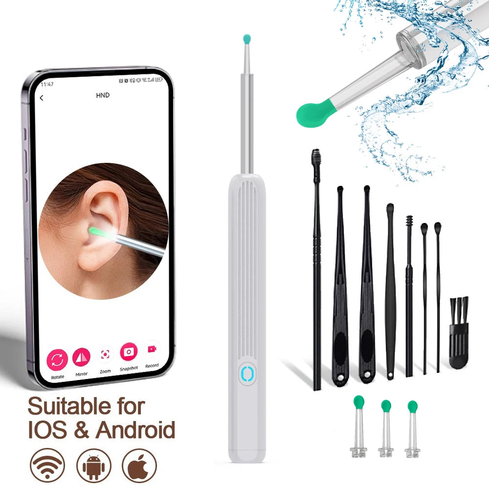 Wireless Visual Ear Wax Cleaner with HD Camera – Safe and Effective Ear Care Solution