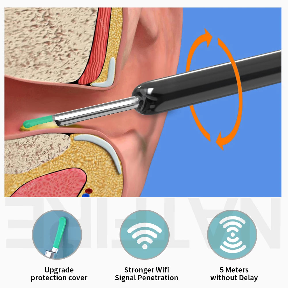 Wireless Visual Ear Wax Cleaner with HD Camera – Safe and Effective Ear Care Solution